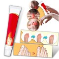 Crema antiinflamatoria para juanetes
