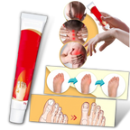 Crema antiinflamatoria para juanetes