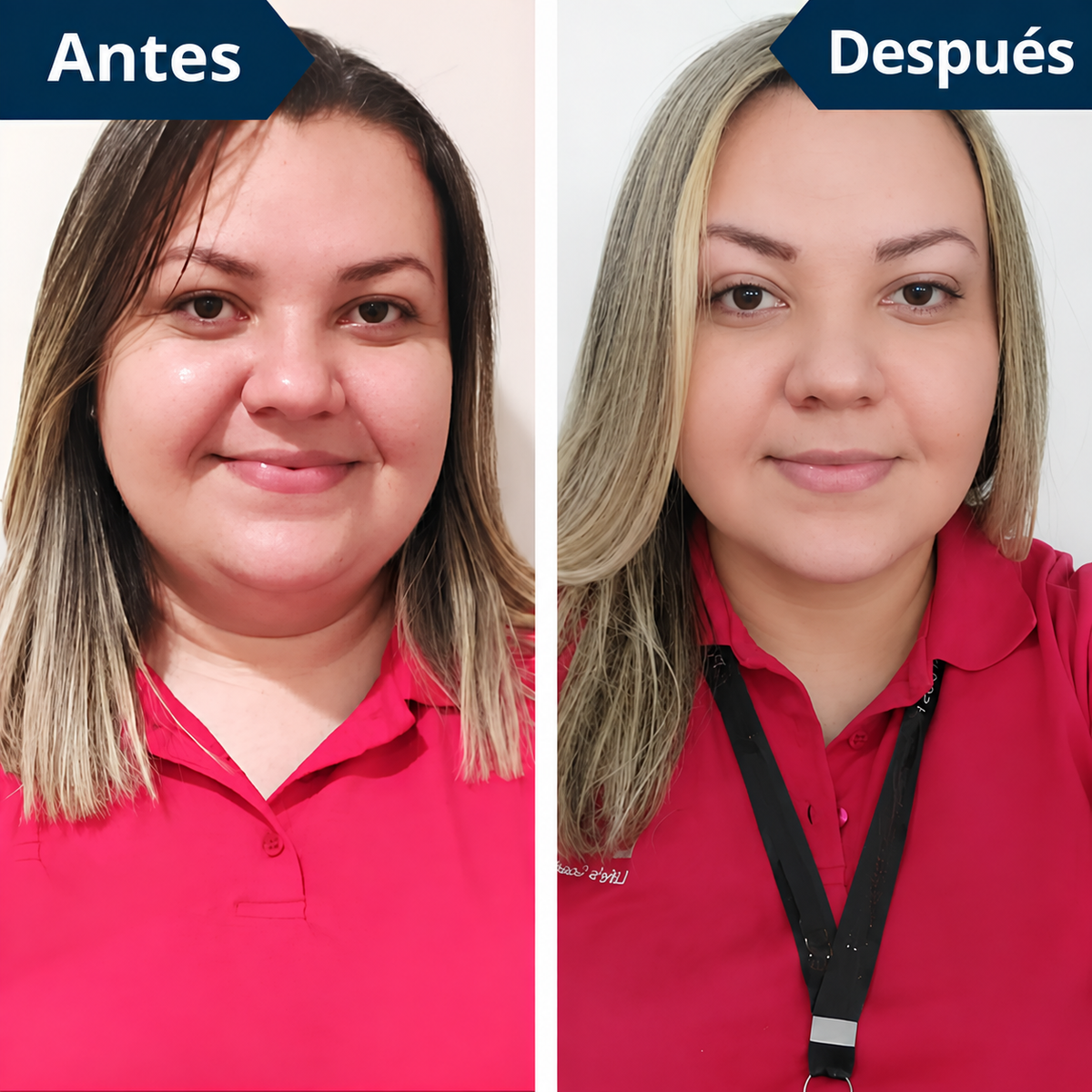 FaceLift™ Reductor de Arrugas y Papada – Recuperá un Rostro Más Firme y Definido + Crema Exclusiva de Regalo