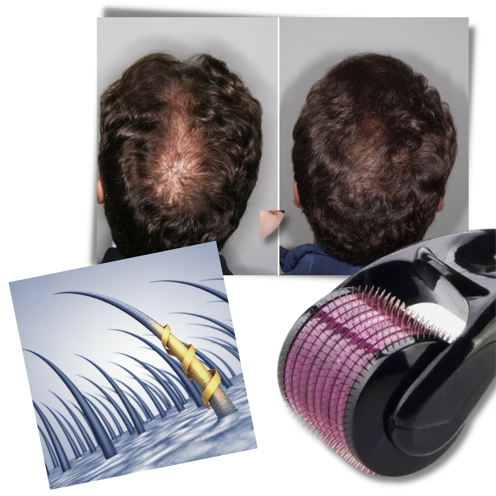 Rodillo Derma para el crecimiento del cabello y la barba
