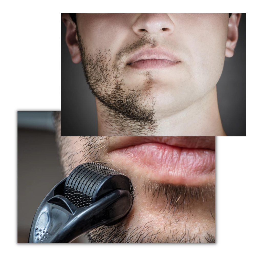 Rodillo Derma para el crecimiento del cabello y la barba