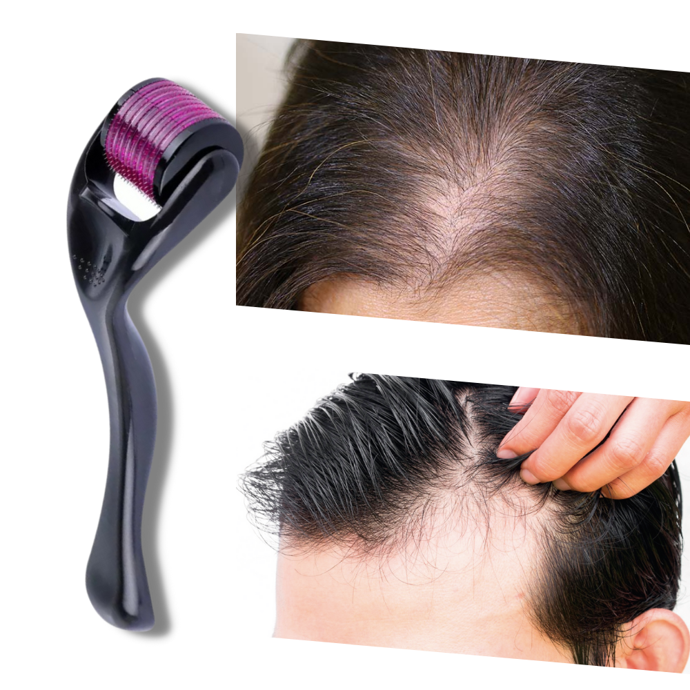 Rodillo Derma para el crecimiento del cabello y la barba