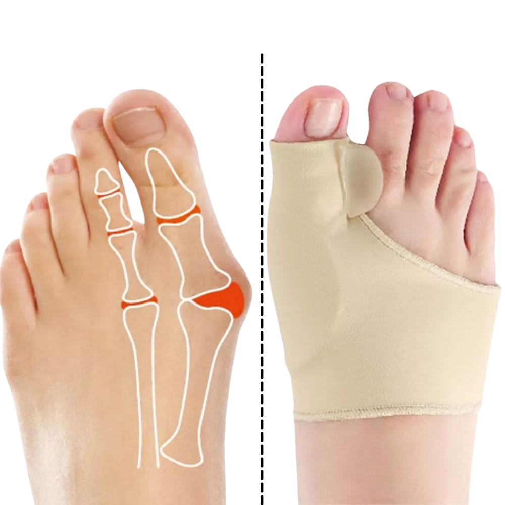 Corrector de juanetes de gel