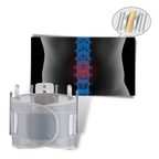 Cinturón lumbar ortopédico