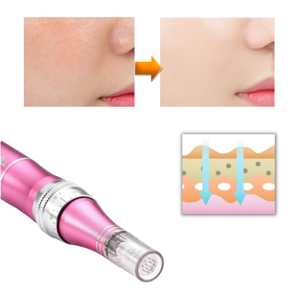 Pluma de microneedling dérmicas