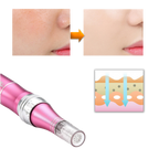 Pluma de microneedling dérmicas