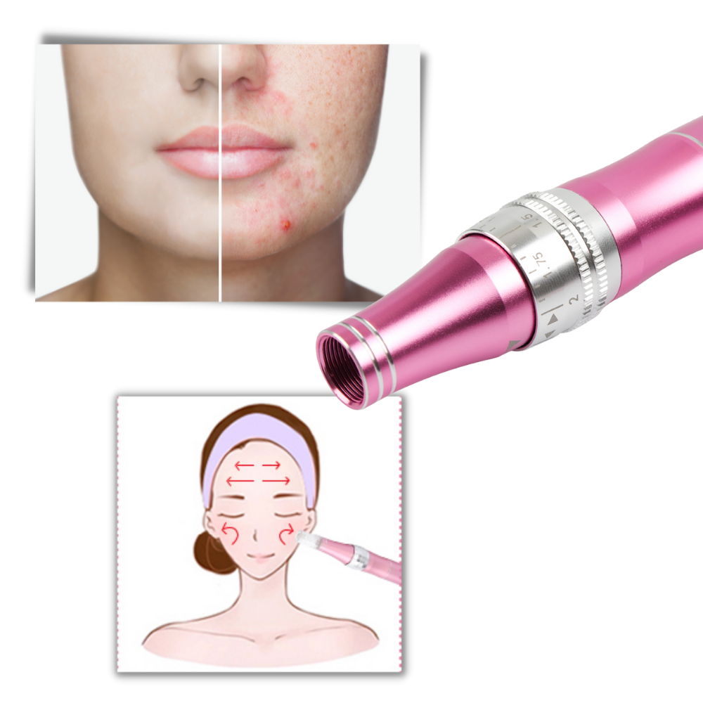Pluma de microneedling dérmicas