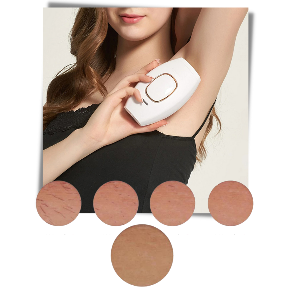 Mini depiladora láser IPL