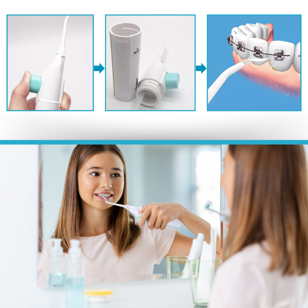 Irrigador dental a base de agua