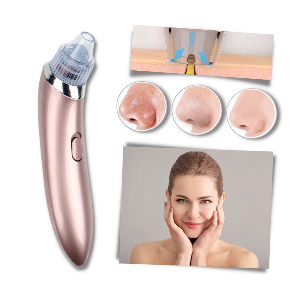 Set de eliminador facial de puntos negros