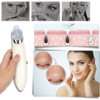 Set de eliminador facial de puntos negros