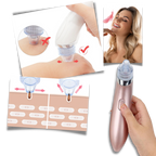 Set de eliminador facial de puntos negros