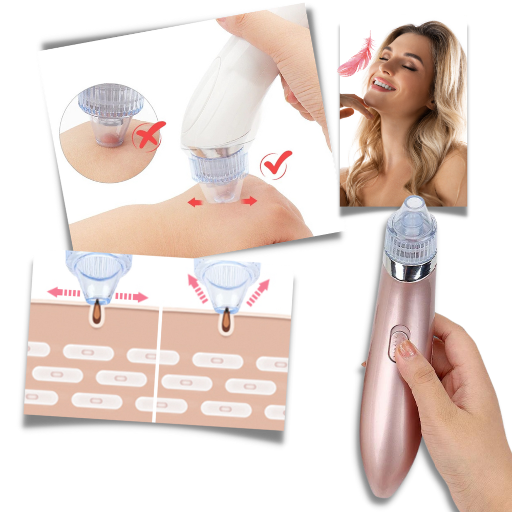 Set de eliminador facial de puntos negros