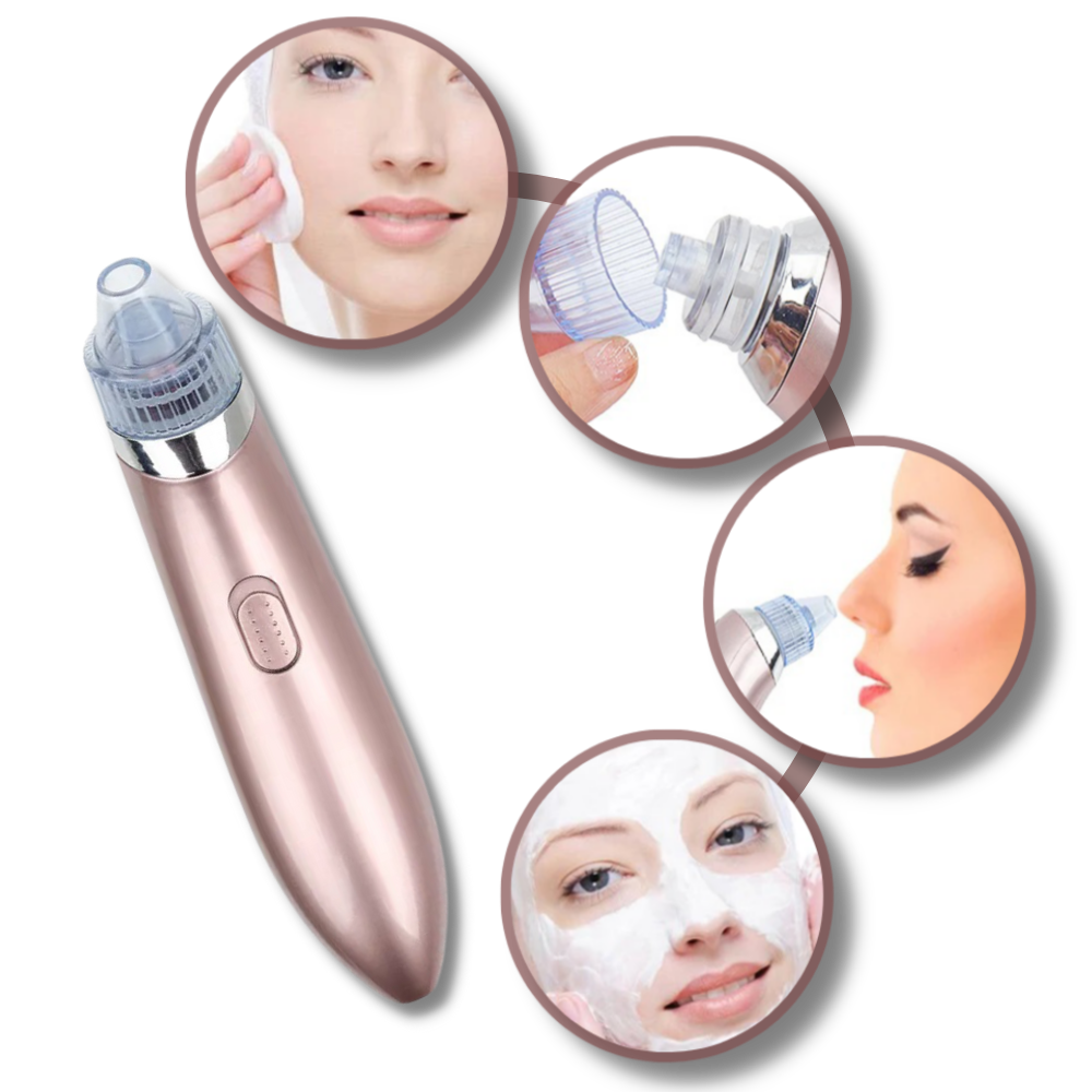 Set de eliminador facial de puntos negros