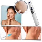 Bolígrafo eliminador de imperfecciones mediante láser