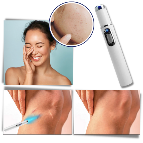 Bolígrafo eliminador de imperfecciones mediante láser