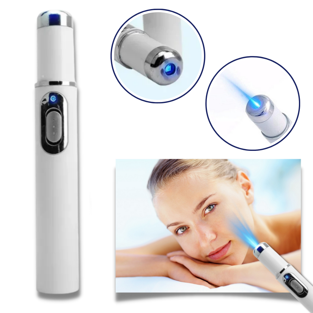 Bolígrafo eliminador de imperfecciones mediante láser