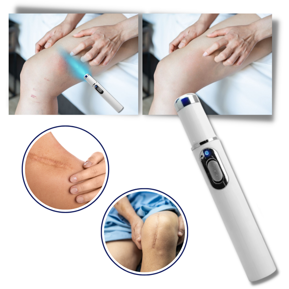 Bolígrafo eliminador de imperfecciones mediante láser