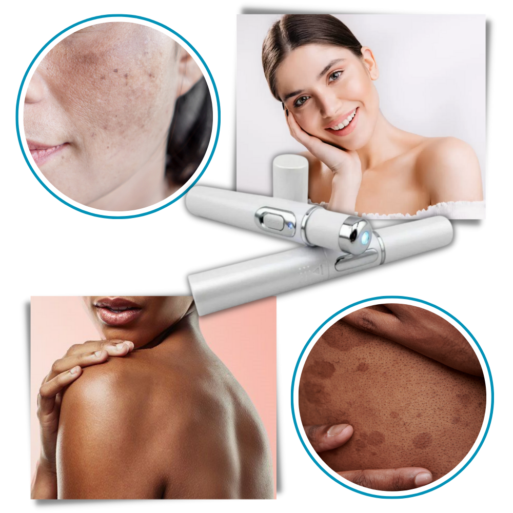 Bolígrafo eliminador de imperfecciones mediante láser