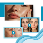 Crema elástica potenciadora de Botox coreana