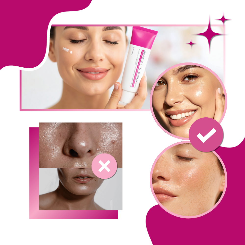 Crema tranexámica Even Skin