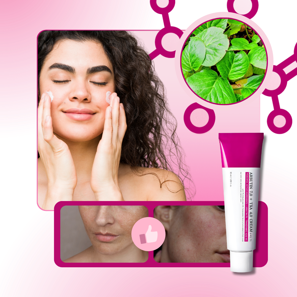 Crema tranexámica Even Skin