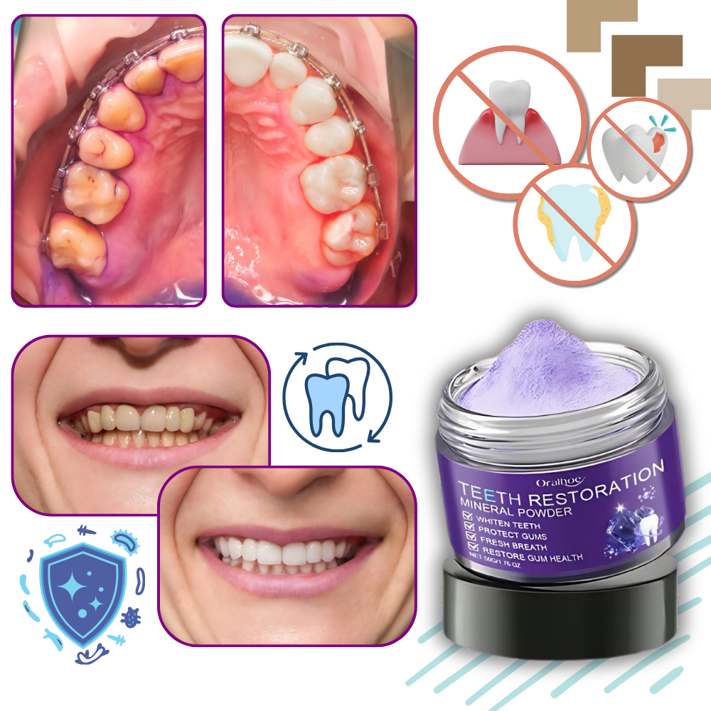 Blanqueador dental Fresh Boost