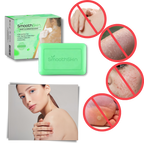 Jabón eliminador de verrugas hidratante y exfoliante
