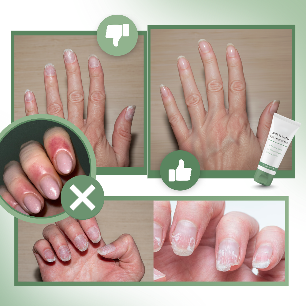 Gel revitalizante e hidratante para uñas