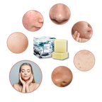 Jabón natural antiacneico con sal marina