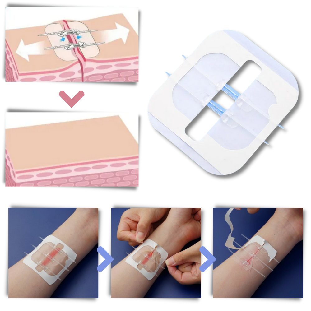 Adhesivo impermeable para heridas