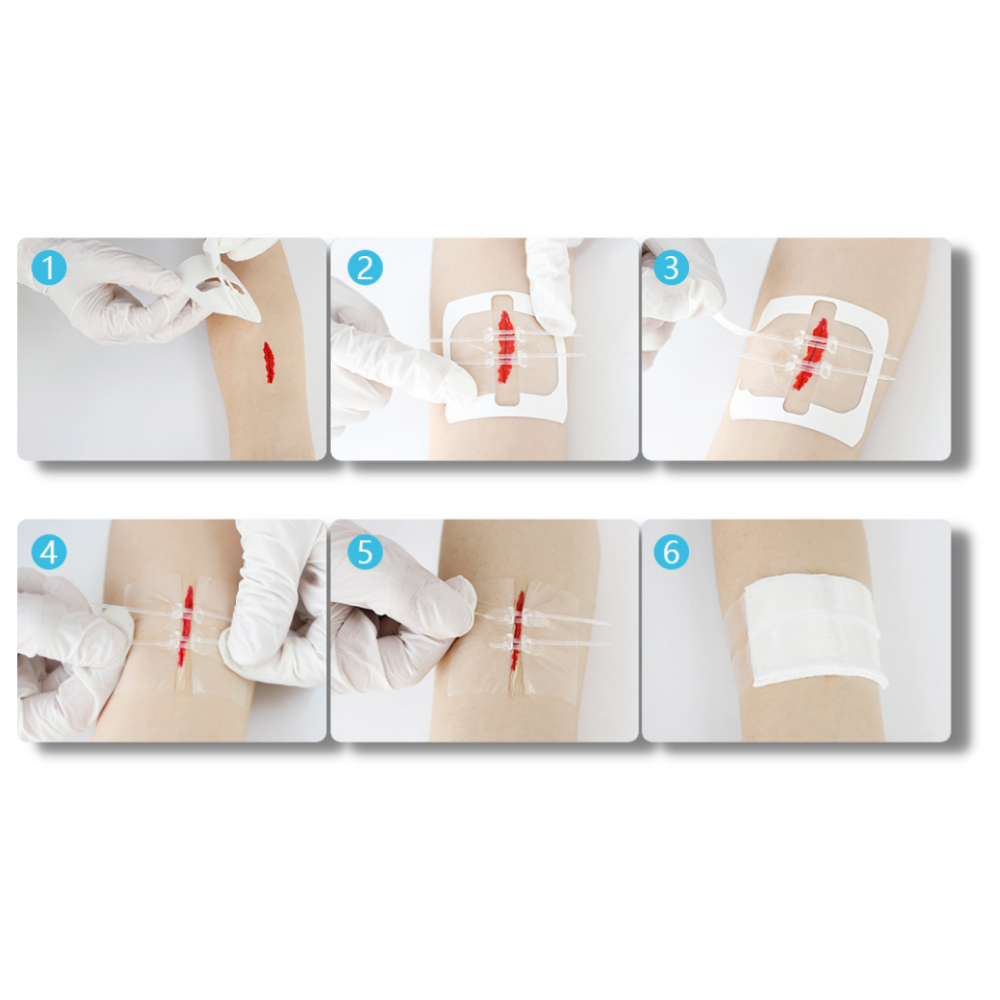 Adhesivo impermeable para heridas