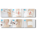 Adhesivo impermeable para heridas
