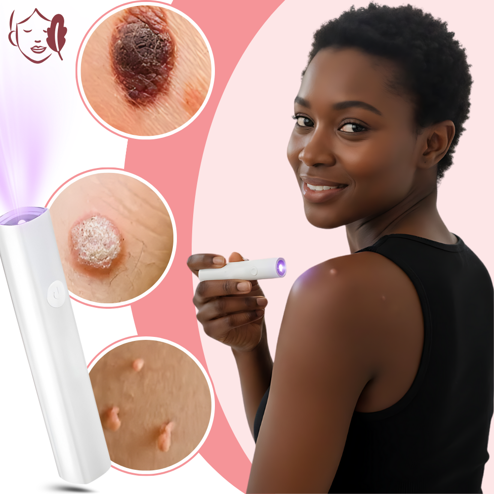 Lápiz láser cosmético Radiance