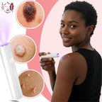 Lápiz láser cosmético Radiance