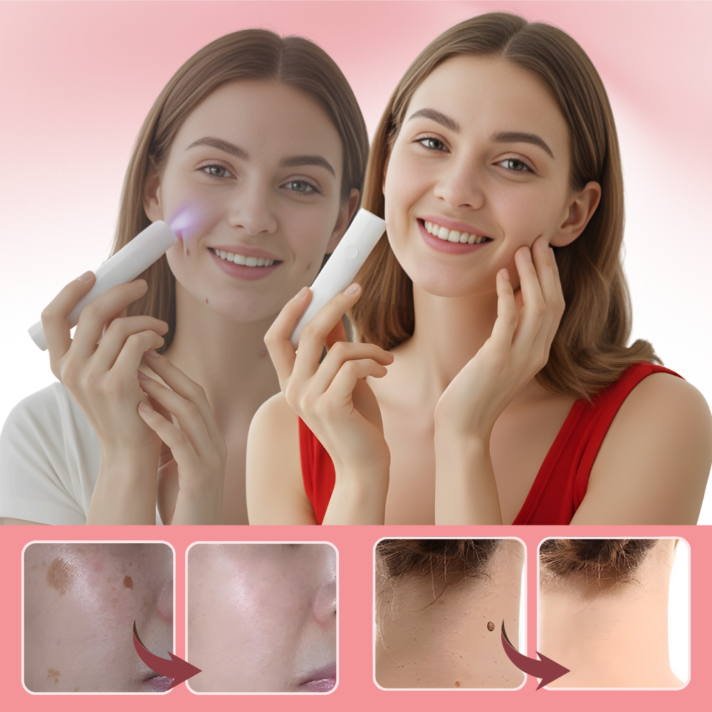 Lápiz láser cosmético Radiance