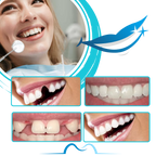 Kit de moldeado de dientes postizos reutilizables
