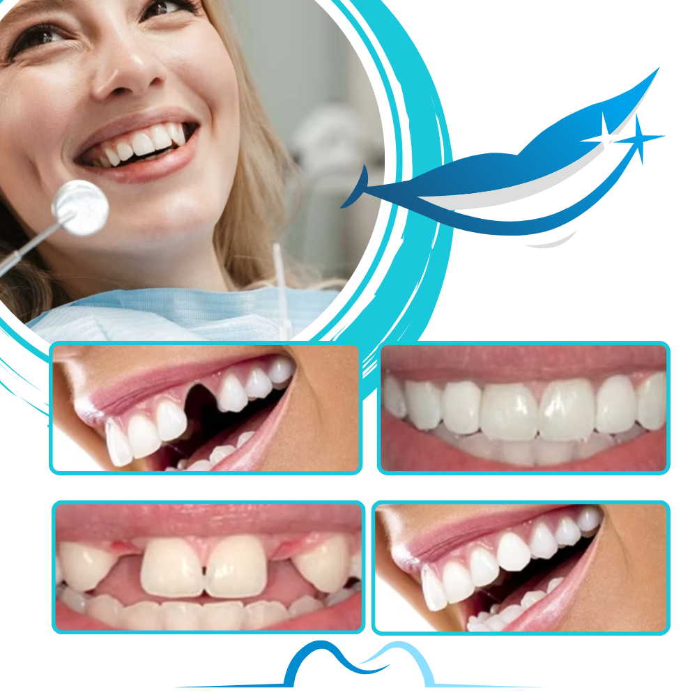 Kit de moldeado de dientes postizos reutilizables