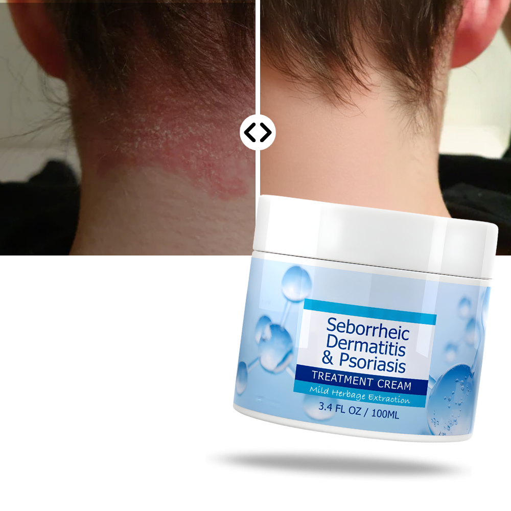 Crema hidratante para el cuidado del cuero cabelludo