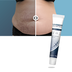 Crema hidratante con silicona para cicatrices