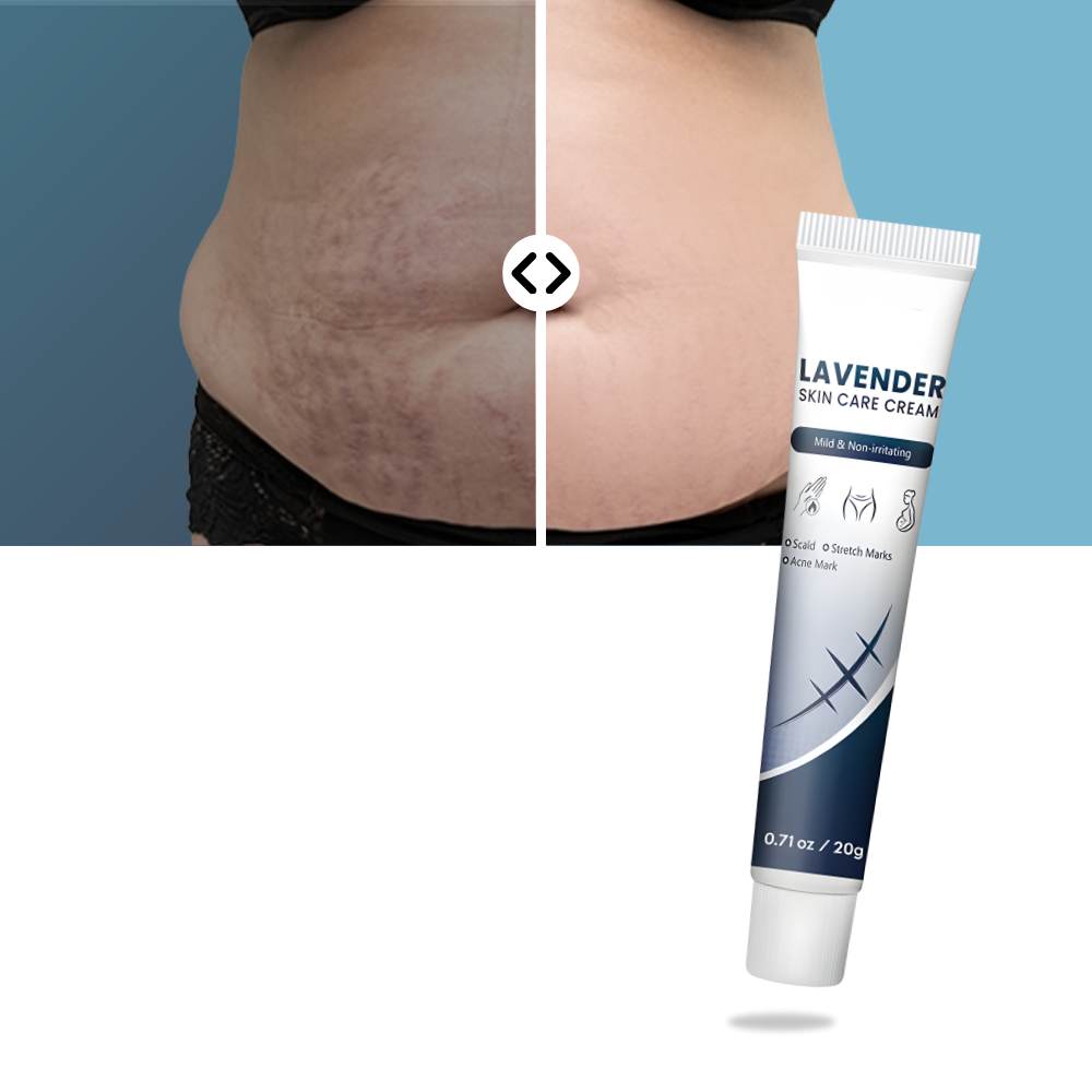 Crema hidratante con silicona para cicatrices