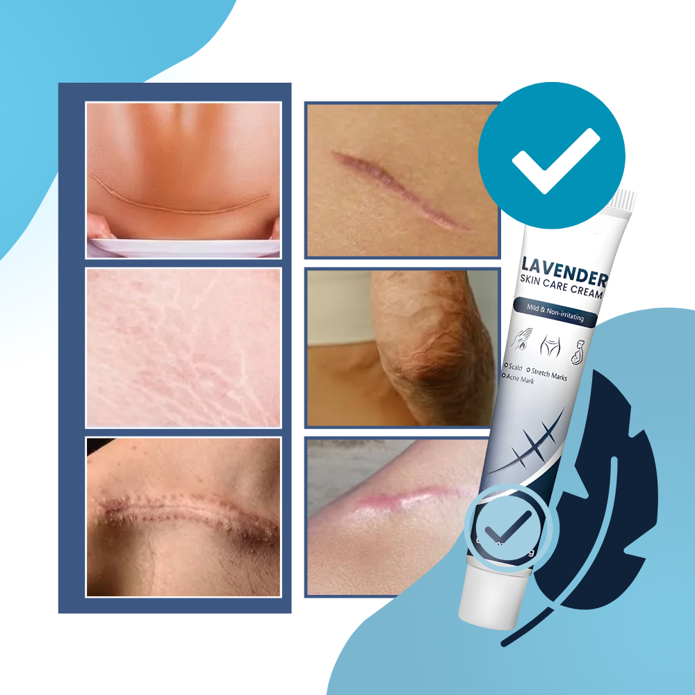 Crema hidratante con silicona para cicatrices