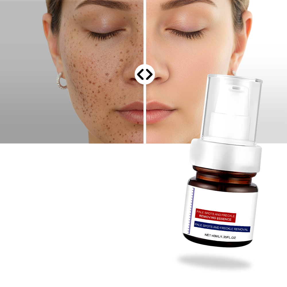 Suero kojic sedoso para iluminar la piel