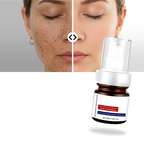 Suero kojic sedoso para iluminar la piel