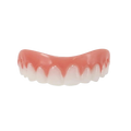 Carillas dentales Snap-On