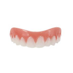 Carillas dentales Snap-On