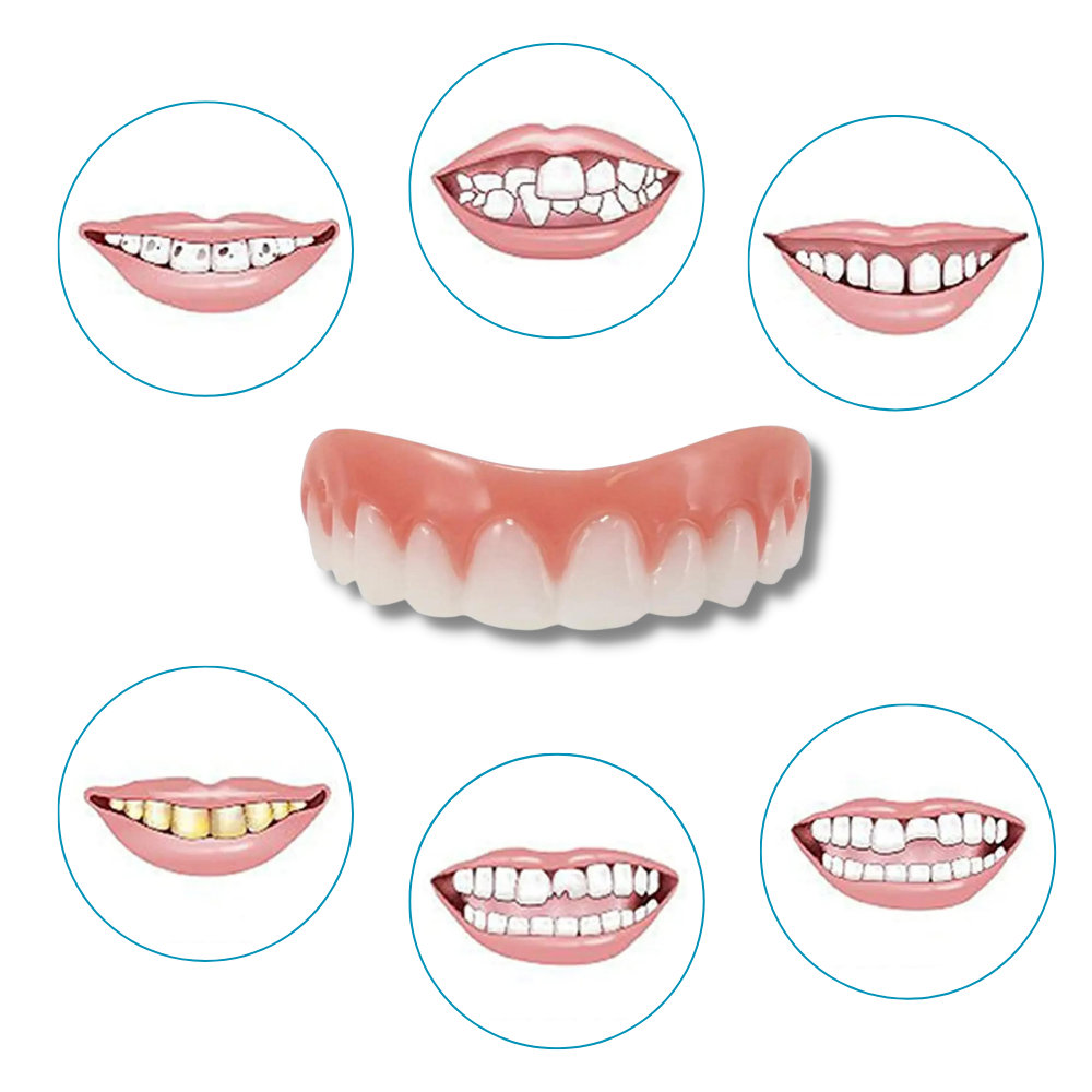 Carillas dentales Snap-On