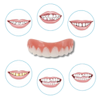 Carillas dentales Snap-On