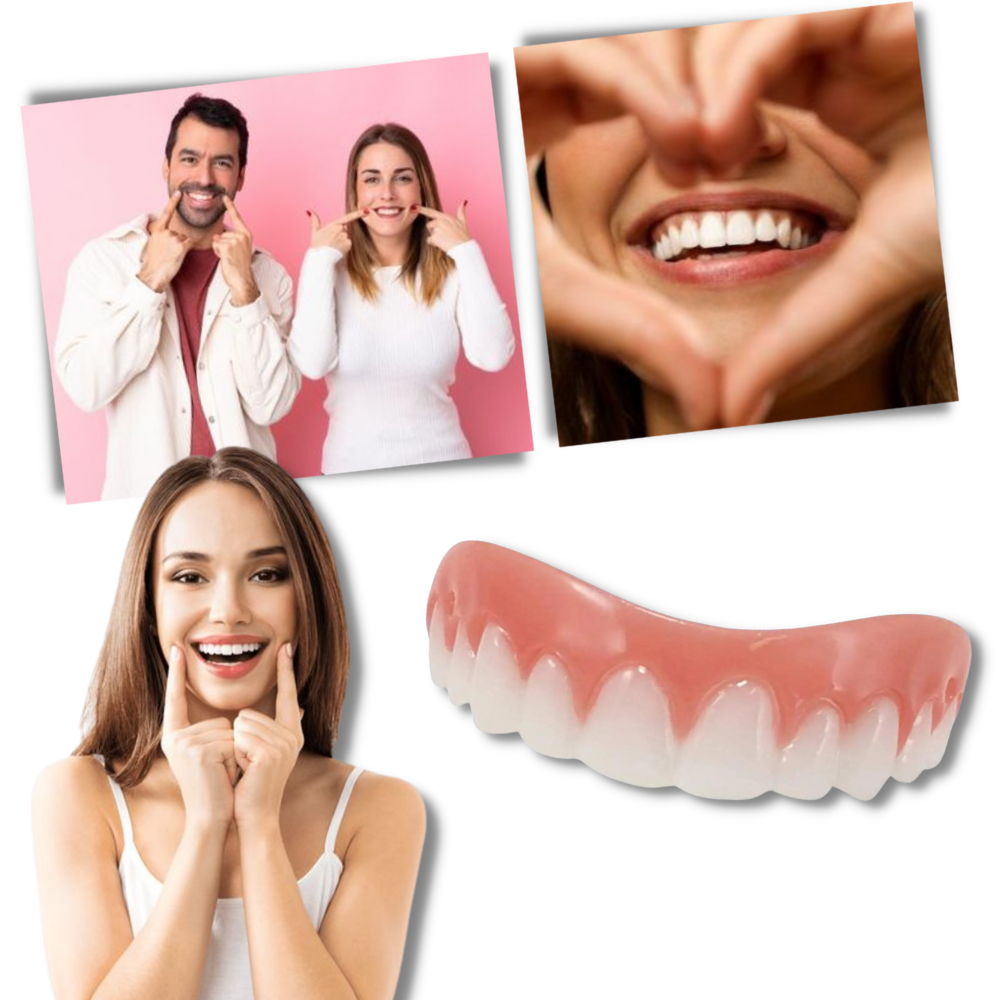 Carillas dentales Snap-On