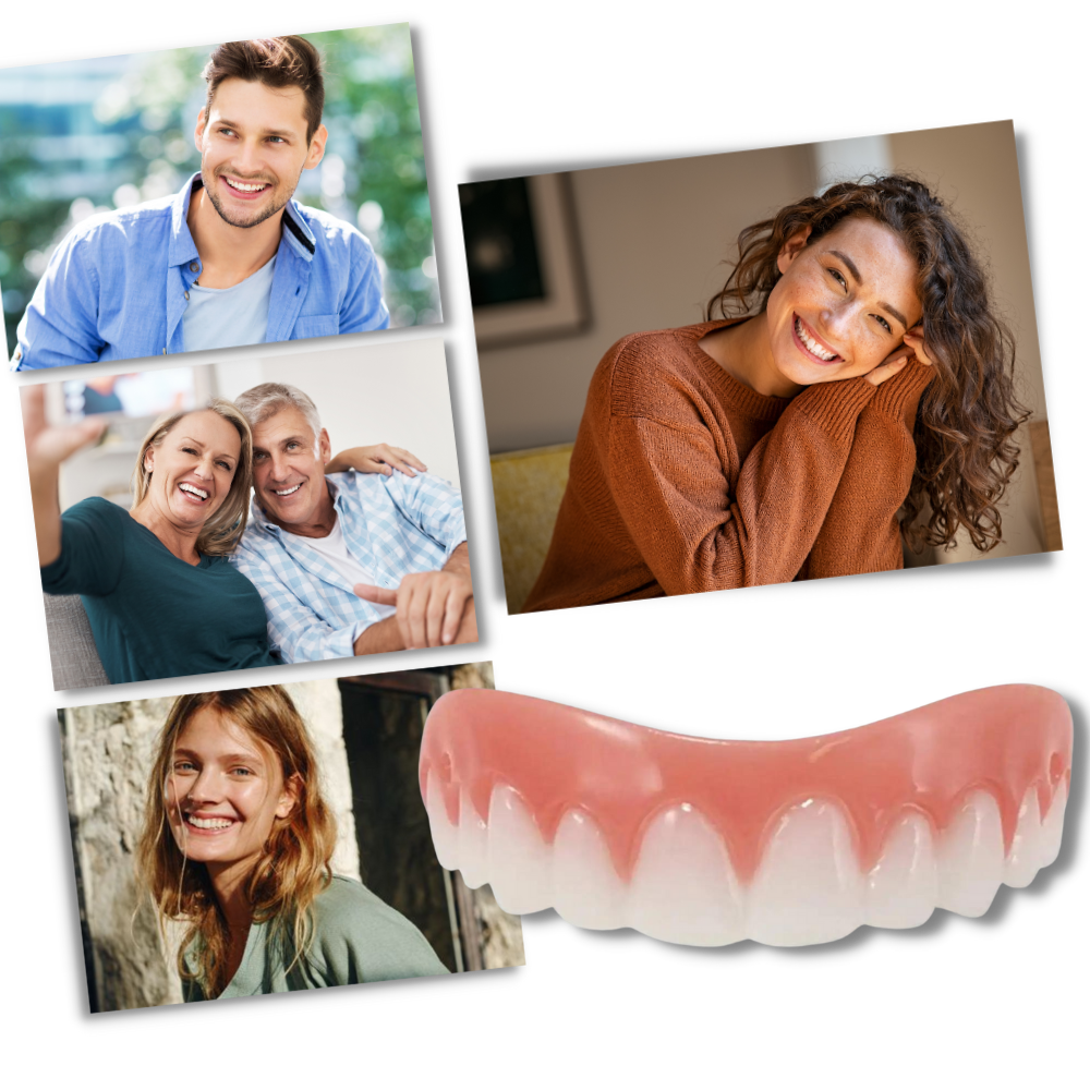 Carillas dentales Snap-On